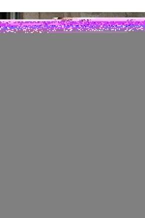 Sarı Eskitme Çift Yönlü Plastik Kasa Gu10 Duy Led Armatür, Yaldız Eskitme Aplik (Ampuller Hariç)