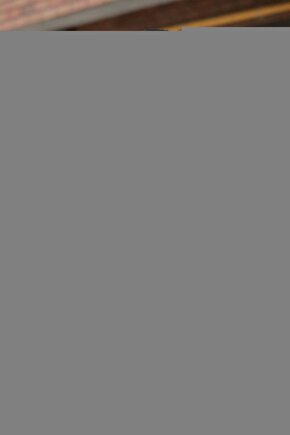 Ayna TerapiFizik Tedavi Terapi Aynası