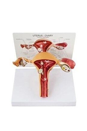 Uterus Pelvik TabanMaketi Model 41