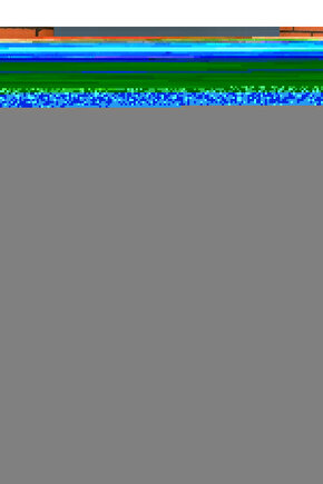 DıspenserYeşil 1.5 Mt