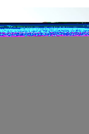 Lastik Turnike-Serum Lastiği Boyut İç Çapı 8 mm