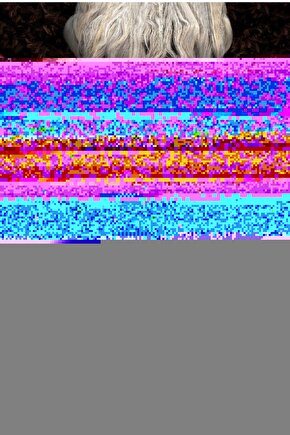 Gözenek Sıkılaştırıcı Sivilce, Leke Ve Siyah Nokta Karşıtı Niacinamide Serum 30 ml