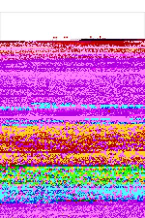 Sphagnum Torf İnce 5 Litre - Steril Yüksek Kalite İthal Bitki Toprağı Sphagnum Torfu Moss Peat