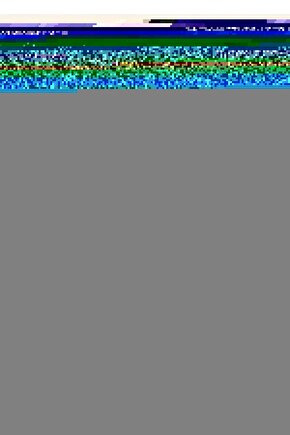 3801150160 160 mm Kerpeten