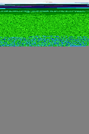 Matisse - Sanat - Soyut - Doğa - Yaşam ( Tekli Çerçevesiz ) Poster - Afiş - Tablo MKKM1283