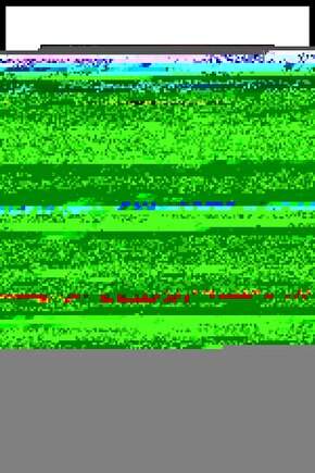 Rt1002-104 Erkek Kol Saati