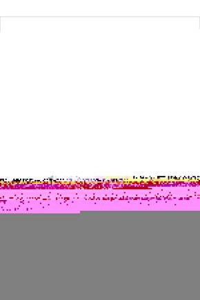 Full Hd 1080p Kamera Bebek Izleme Ve Güvenlik Kamerası Wifi 360 Derece Dönebilen Kamera