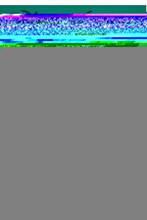 Kablosuz Kas Kuvvetlendirme ve Vücut Şekillendirme StimülatörüWIRELESS FIT5.0