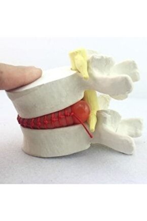 Disk HernisiFıtık Maketi Model 2
