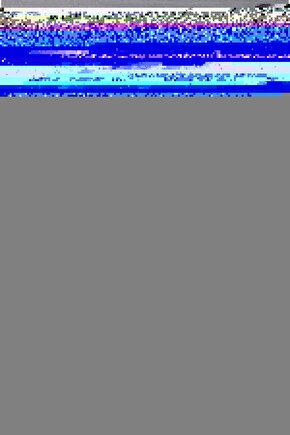 Msd Digi-flexEl Parmak Güçlendirme Yayı , El Parmak Egzersiz Aleti Kırmızı Renk (hafif)