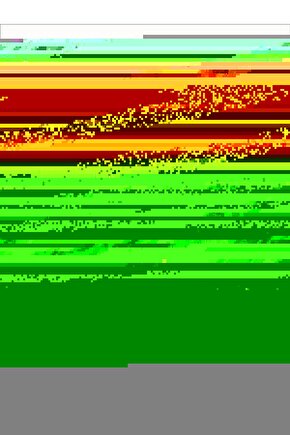 Ac 4020 Taşınabilir Mesh Nebulizatör Çok Hafif Süper Sessiz