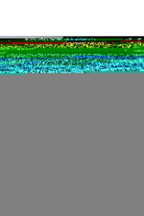 Akülü Sandalye Şarj Aleti Şarj Cihazı 5 Amper 24 Volt