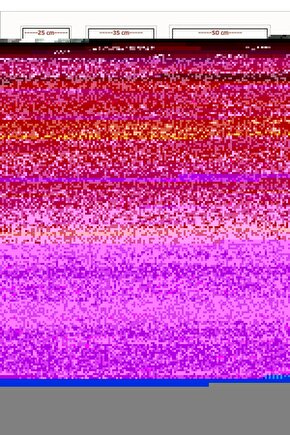 Venom (2018) 0001 AFİŞ - POSTER ( FOLYO ) - AFİŞ - POSTER-8582