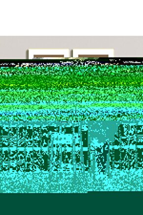 Matisse - Sanat - Soyut - Doğa - Ev - Yaşam ( 2 Li Çerçevesiz ) Poster - Afiş - Tablo NNHT517