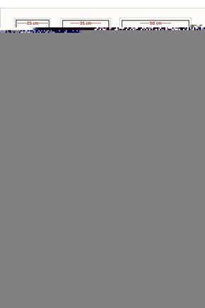 Sarı Baskılı Kolları, Beli Ve Boynu Lastikli Sweatshirt