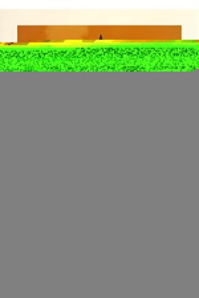 Lumbosakral Çelik Balenli Bel Fıtığı Korsesi Standart Beden Her Bedene Uygundur