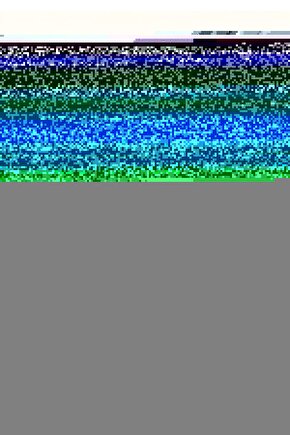 Sport Tape Yeşil Renk Kinezyo Sporcu Bandı Ağrı Bandı 5 Metre X 5 Cm