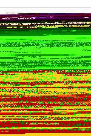 Karın Kası KemeriEm 32 Çift Elektrotlu