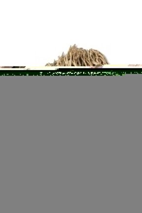 Döküm & Pres Bileklik