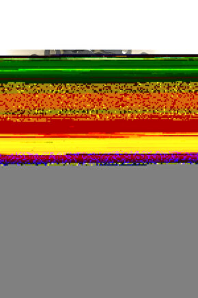 6’lı Kapaklı Saklama Kabı Seti - Küçük Boy - Porsiyonluk - Kahvaltılık Çerezlik