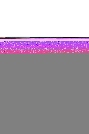 Her Saate Uygun  Hasır Görünümlü saat  kordonu 20 mm Siyah