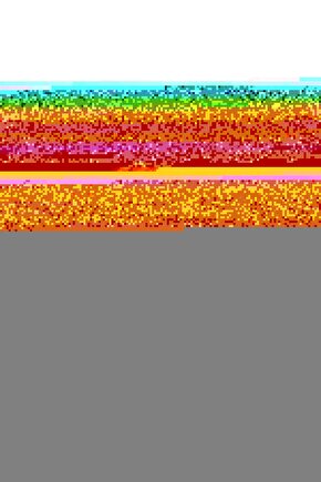 BROTHER OVERLOK 551 SERİ İĞNE  DESTEĞİ