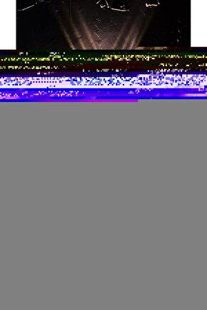 ALLİFE Tens Cihazı 16 pedli (Türkçe menü)