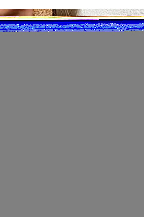 Dizüstü Çorabı Burnu Açık (orta Basınç)