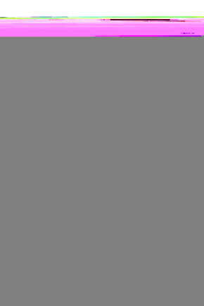 Elastik Baldırlık Bej 802 Varis Çorabı Tipi