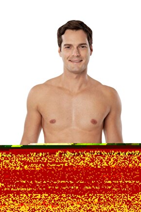 136 Kolostomi Korsesi