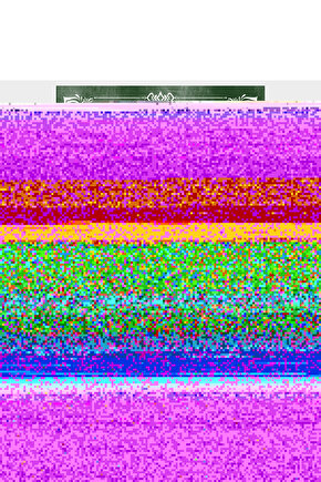 JY122 Mode Bağcıklı Süet Erkek Günlük Sneaker Ayakkabı SBT - Mavi