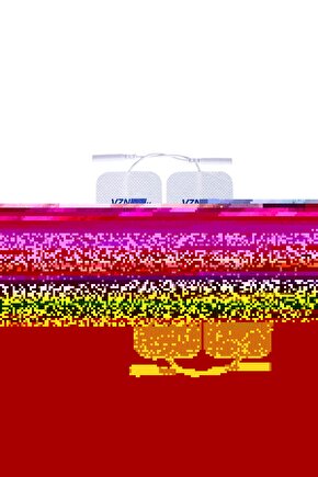 Kablolu Tens Pedi Kablolu Tens Elektrodu 5x5 Cm