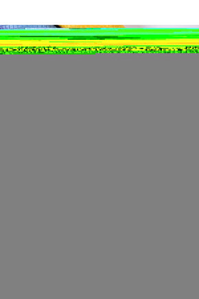 Şampuanlı Hasta Silme Vücut Temizleme Süngeri (400 Adetli)