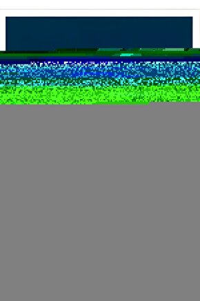 Braun 6520 İrt Thermoscan 7 Braun Kulaktan Ateş Ölçer