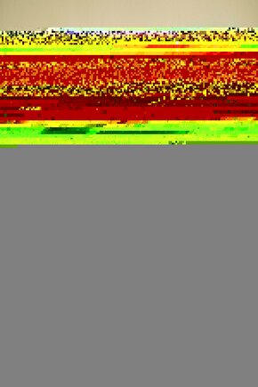 Aşil Tendon Bilekliği Örgü XL