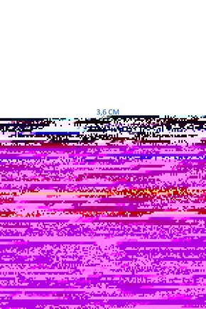 Matisse - Sanat - Soyut - Doğa - Yaşam ( Tekli Çerçevesiz ) Poster - Afiş - Tablo MKKM2158