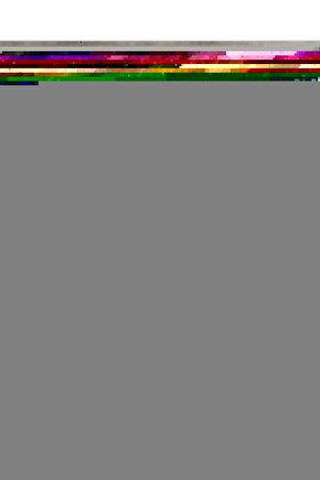 Mercedes A Class W169 Için Yolcu Tarafı Cam Düğmesi Kapağı