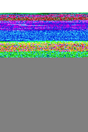 Matisse - Sanat - Soyut - Doğa - Yaşam ( Tekli Çerçevesiz ) Poster - Afiş - Tablo MKKM1317