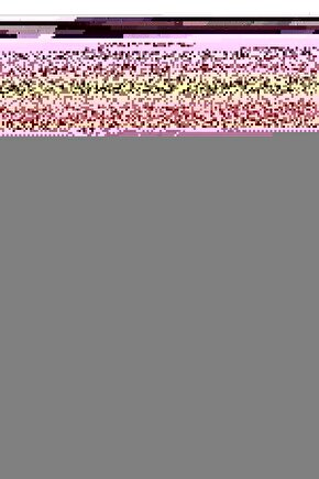 Triflo Solunum Egzersiz Cihazı - Rabır - Nefes Egzersiz Cihazı Kutusuz