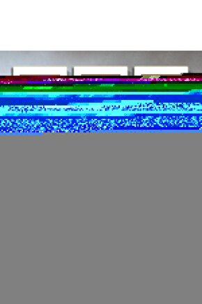 000117 Fussbettpantoffel Günlük Parmak Arası Lila Kadın Terlik