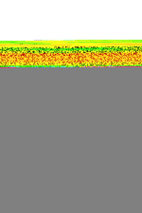 İrem Derici ( Dantel ) CD