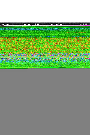 3 Katlı Lüx Siyah Salda Sebzelik Patates Soğanlık Kovası Çeyizlik Tekerlekli Meyve Sepeti