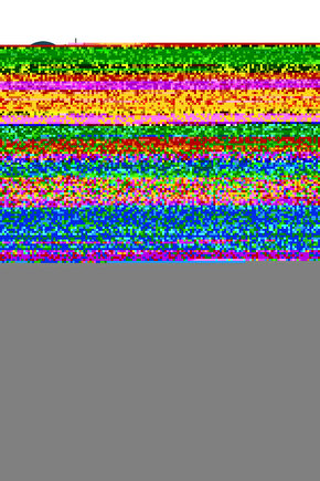 Erkek Baskılı Oversize T-shirt - Siyah