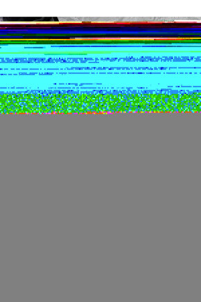 Doğal Taş Damla Kehribar Bileklik