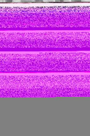 LAMIA Cırt Cırtlı Ortopedik Taban Kadın Sandalet CST - Siyah