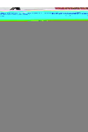 Nipel Tavuk Suluk Yaylı Çanak 100 Cm 5 Adet Yaylı Çanak