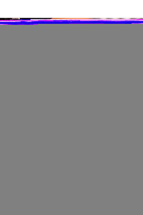 Kanedyen Diz Destekli Koltuk Altı Değneği Ayarlanabilir 2 Adet