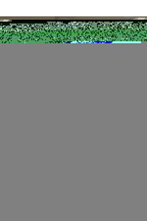 Plastik yuvarlak kase 250 cc Bodega  30 adet - kapaklı