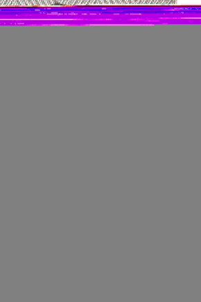 Bej Desenli Ve Önü Düğmeli Keten Elbise