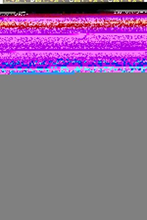 G-120 Klozetli Manuel Tekerlekli Sandalye  Commode Manual Wheelchair